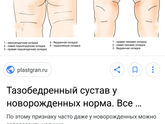 Пропала складка