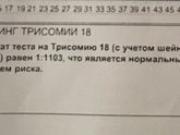 Инвитро VS KDL