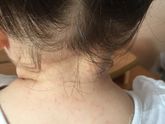 Девочки на что похоже?аллергия?только