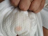 Выделения из писюна