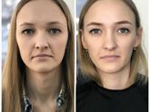 Брови