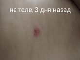 Появились пузырьки, на вид