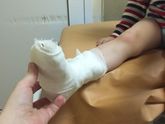 Сын в гипсе,я в панике