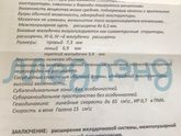 Узи ГМ стало хуже