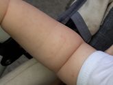 Девочки,мамочки подскажите это потничка?Если