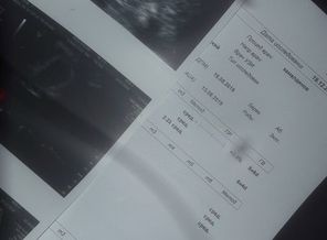 IMG-20181219-WA0012