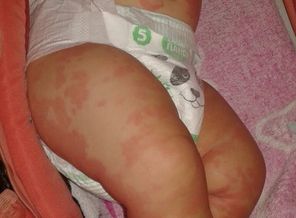 IMG-66a9561e0af1b18ff11ebd003d26f5df-V