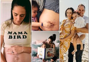 Блог честной мамы: иногда беременность может оставлять некрасивые «рубцы»