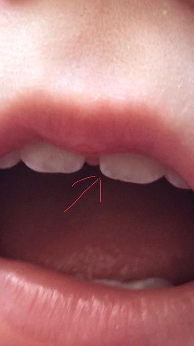 Что это может быть на зубике?