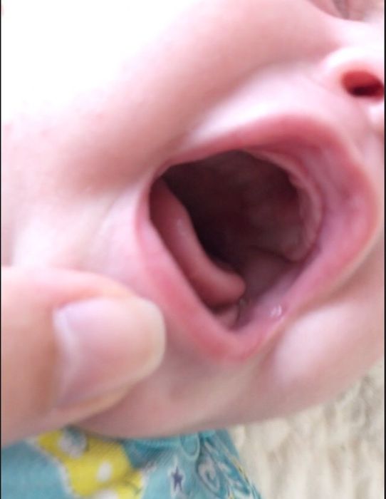 Полость рта ребёнка