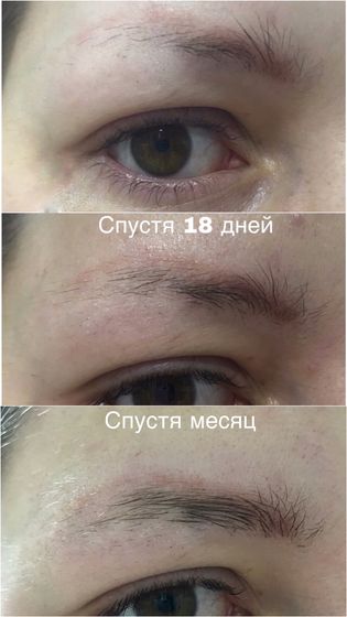 Брови, средство для роста бровей.