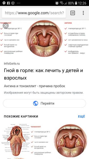 мамочки кто мучается с горлом у детей?