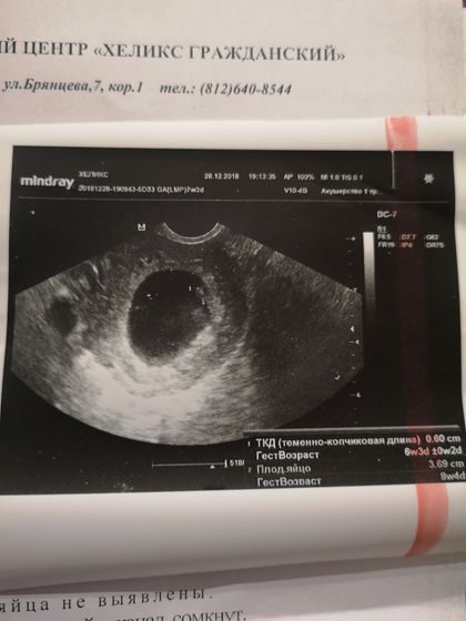 Большое плодное яйцо