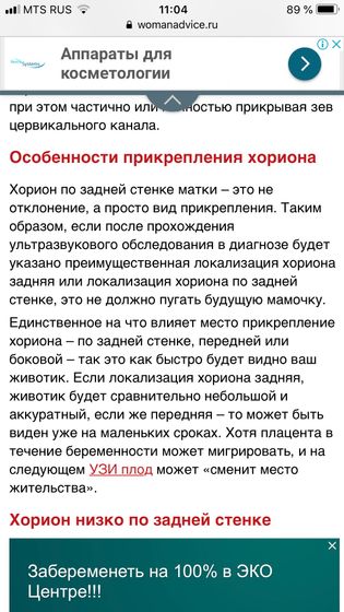 Сходила на УЗИ - рассказываю как и обещала