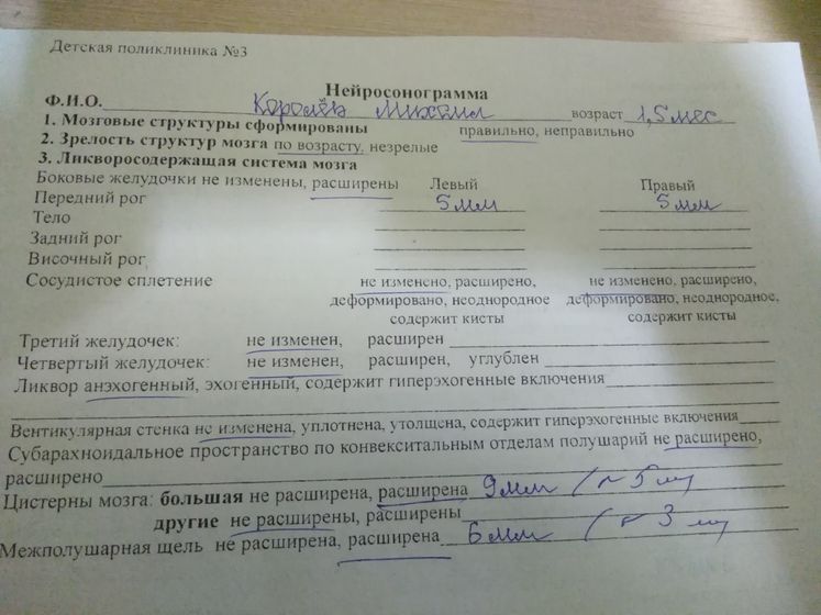 Расширение межполушарной щели и большой цистерны