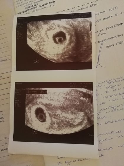 После выписки снова начала кровить...