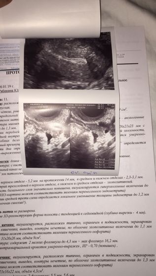 Ходила сегодня к Пятых Наталье Сергеевне , делала допплер УЗИ