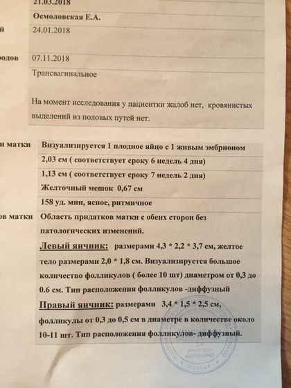 УЗИ