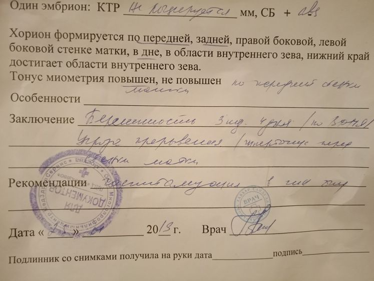 Хорион по двум стенкам