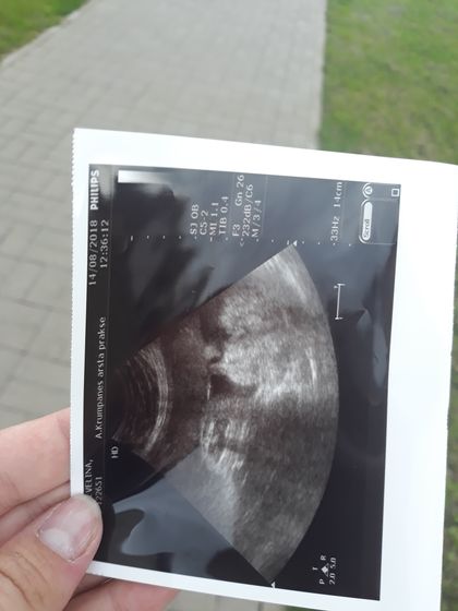 Счастью нет придела!!!😍😍😍💞