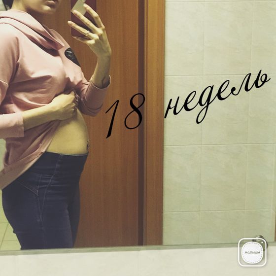 Односрочницы!!! 18-20 нед. И не только!!