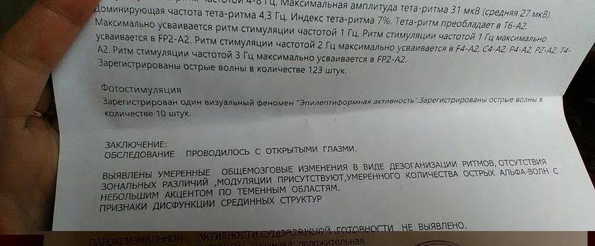Особый ребенок.ээГ