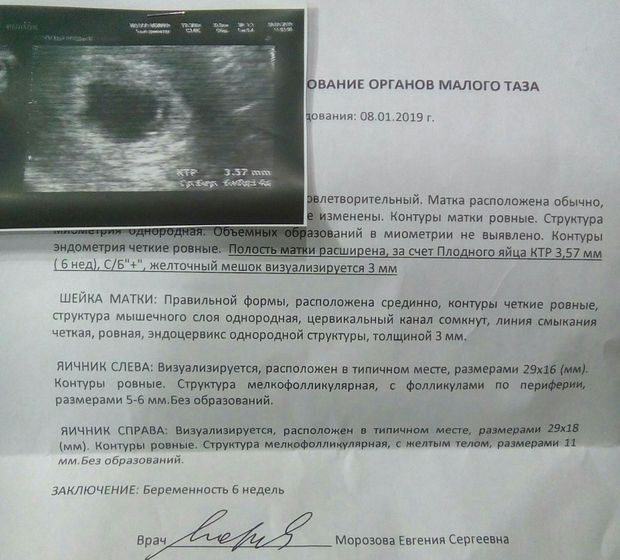 Первое УЗИ, 6 недель.