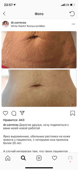 Лохотрон ??