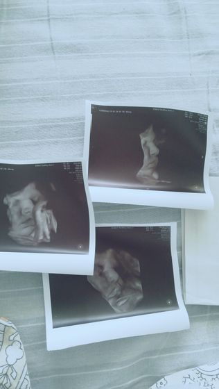 Осмотр врача в роддоме