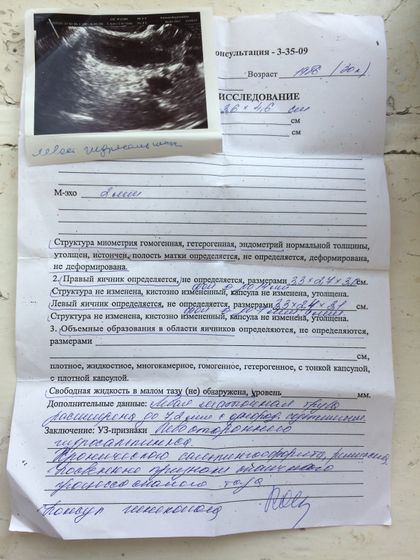 УЗИ