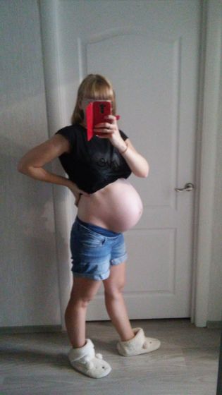 Подготовка шейки к родам