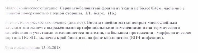 Нашли впч 16 типа