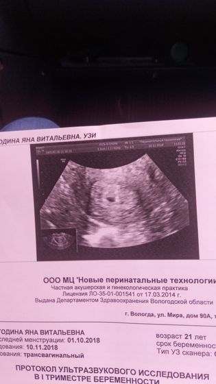 Узи