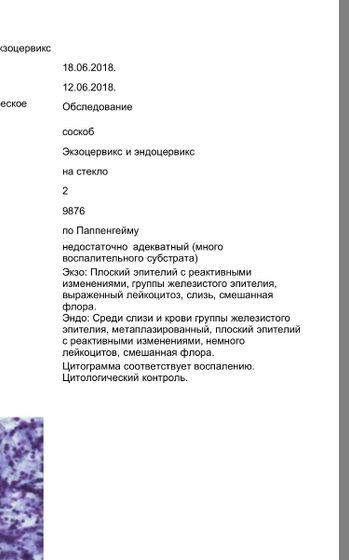 Дадут ли квоту?