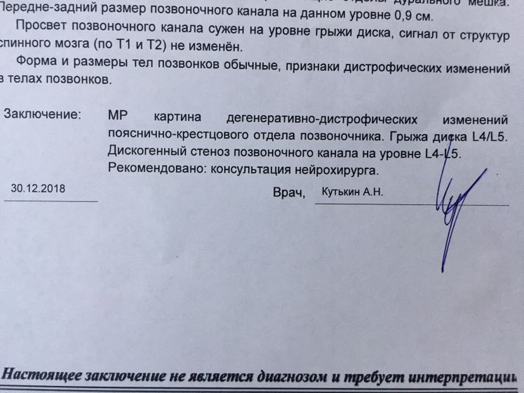 Грыжа позвоночника.