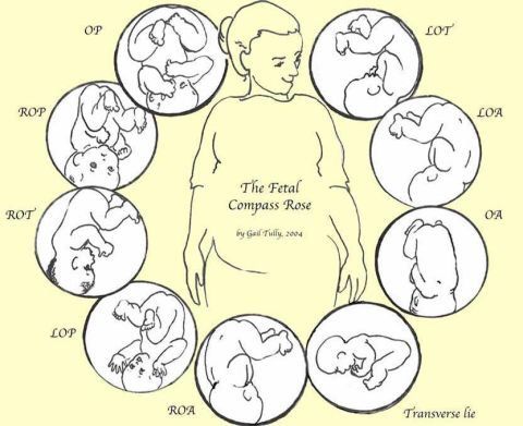 Положение малыша🤰🏼