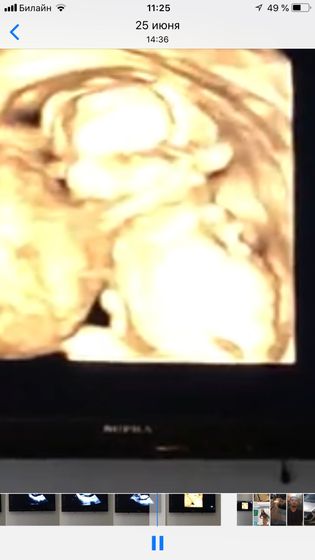 Определяем пол по фото