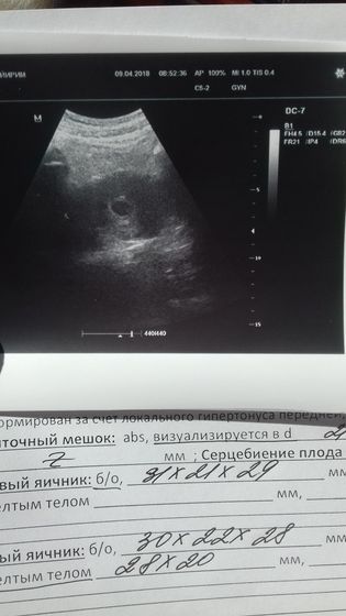 Официально беременна