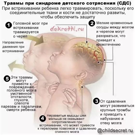 Синдром детского сотрясения
