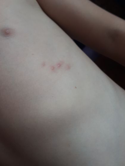 Странные прищики или что это