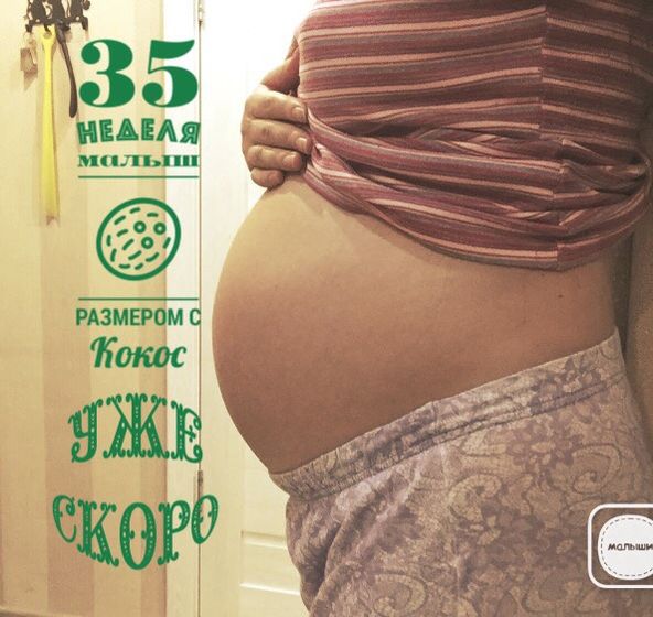 35 недель!Боже