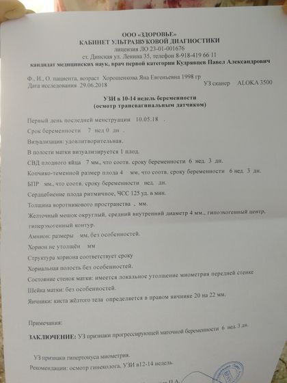 Узи???