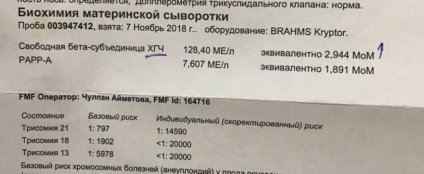 Хгч