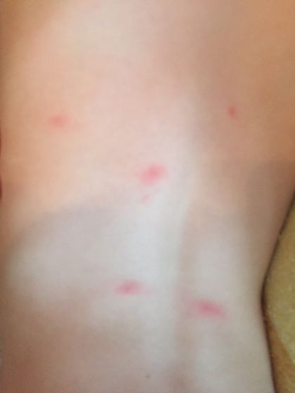 Сына высыпало, Непонятно что