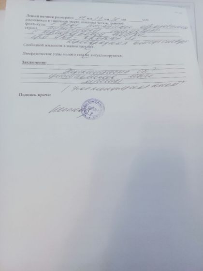 Кисты яичника и ЭКО