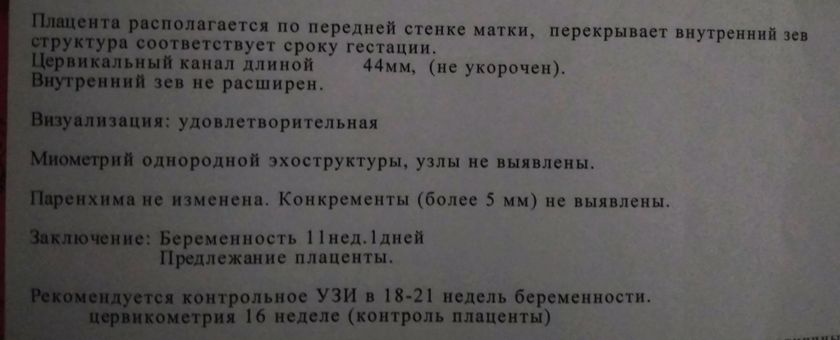 Предлежание плаценты