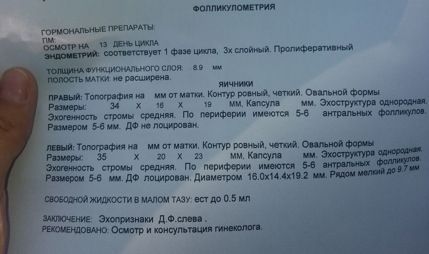 Фолликуломитрия