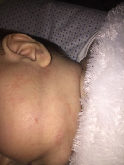 Что это может быть? СЫПЬ