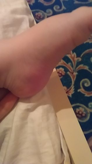 Девочки видите эти шишки