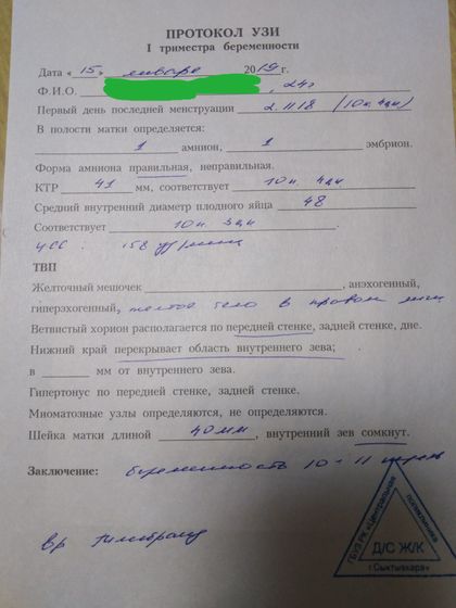 Узи, стационар